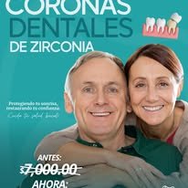 Promoción: Implantes dentales